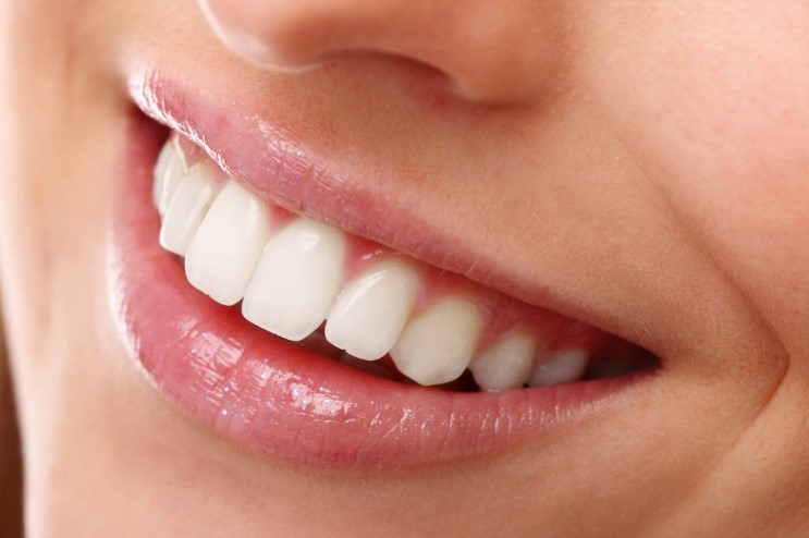 Inilah Pengertian Gigi Kelinci dan Penyebabnya